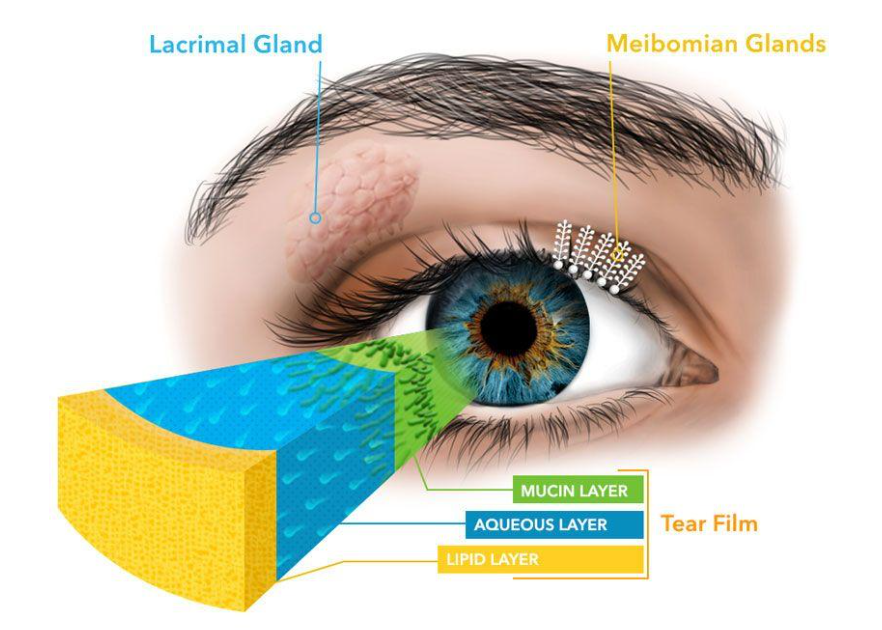 Suffering From Dry Eyes You May Have Meibomian Gland Dysfunction Suffering From Dry Eyes You May Have Meibomian Gland Dysfunction