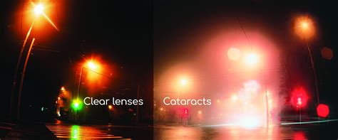 Clear Vision versus Blurry Vision when driving