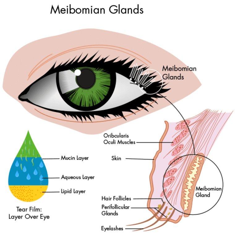 Dry Eye Disease & Meibomian Gland Dysfunction