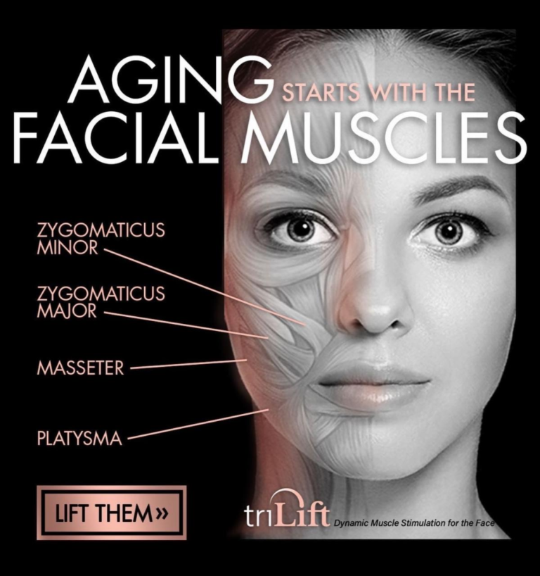 TriLift workout on facial muscles