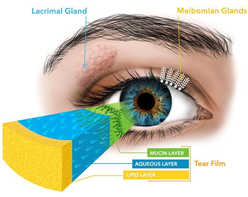 Meibomian Gland Dysfunction Treatment 